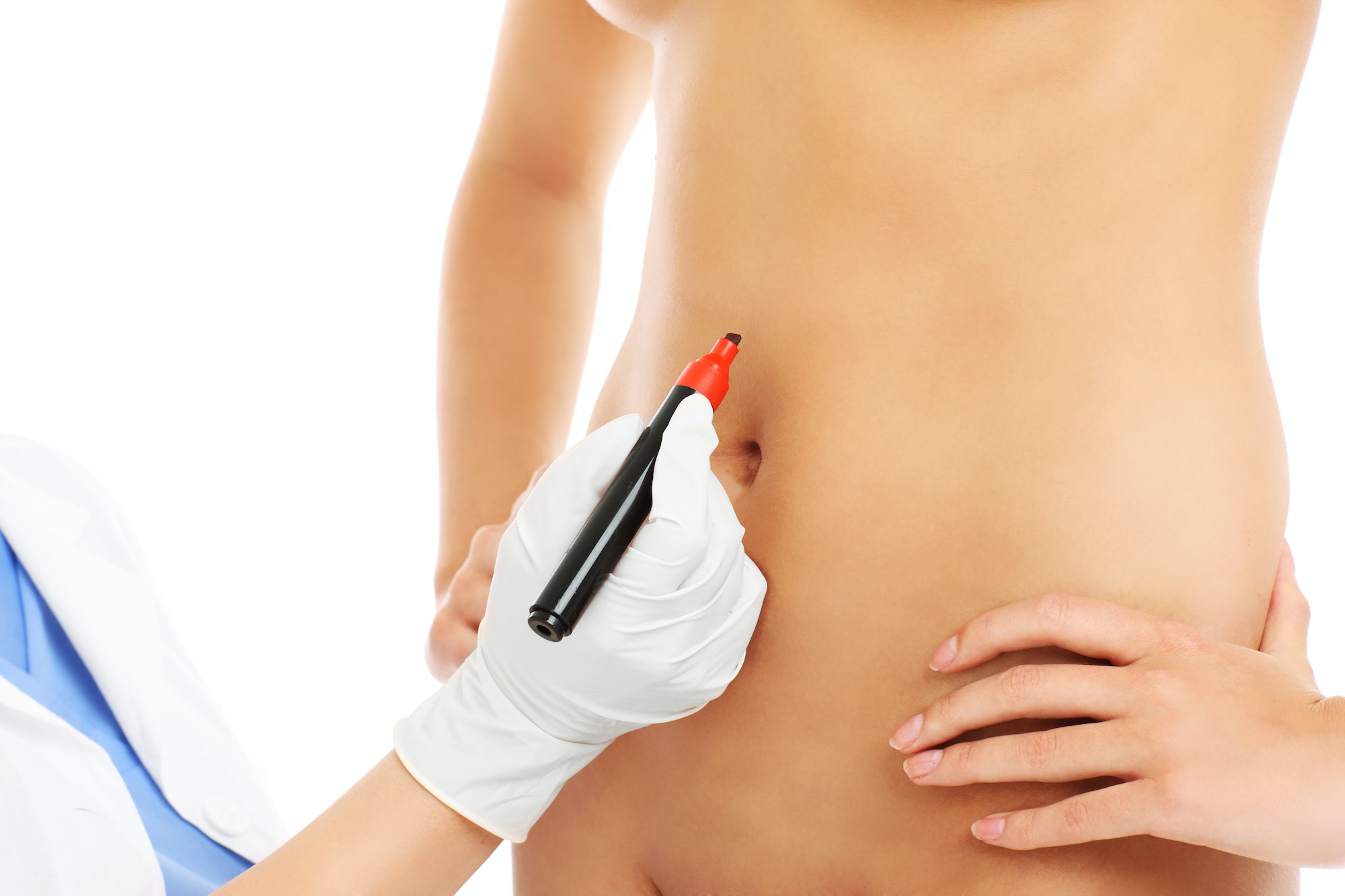 Doctor marking belly for surgery